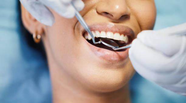 Best Emergency Tooth Extraction in Gladstone, MI