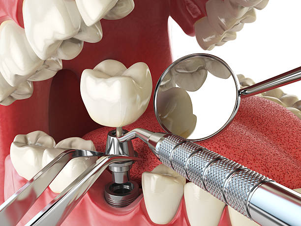 Best Emergency Dental Surgery in Gladstone, MI